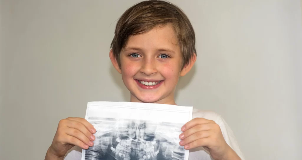 Pediatric Dental X-Rays - Kid Grins Is Who You Want for Pediatric Dental X-Rays