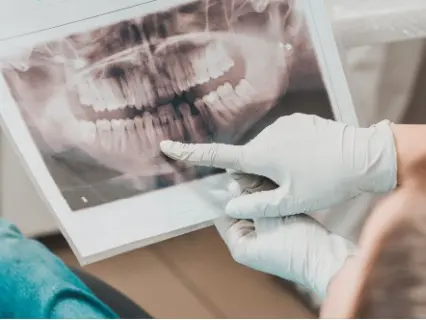 Reasons Kids Need Dental X-Rays - Kid Grins Will Help You Why You Need X-Rays Reasons Kids Need Dental X-Rays - Kid Grins Will Help You Why You Need X-Rays