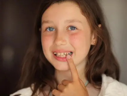 Reasons to Get a Dental Crown for your Child - Kid Grins Will Help You Decide Reasons to Get a Dental Crown for your Child - Kid Grins Will Help You Decide