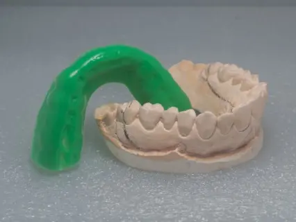 Get a Personalized Sports Mouthguard from your Pediatric Dentist - At Kid Grins Get a Personalized Sports Mouthguard from your Pediatric Dentist - At Kid Grins