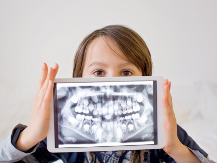 early-orthodontic3