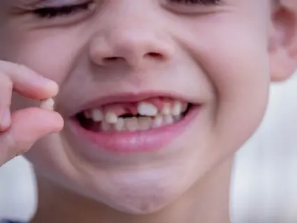 If Your Child Knocks Out Baby Tooth - Kid Grins Is Who You Need To Fix The Knocked Out Tooth If Your Child Knocks Out Baby Tooth - Kid Grins Is Who You Need To Fix The Knocked Out Tooth