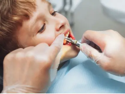 Possible Root Canal Alternatives for Kids - Kid Grins Shows You All the Possible Alternatives